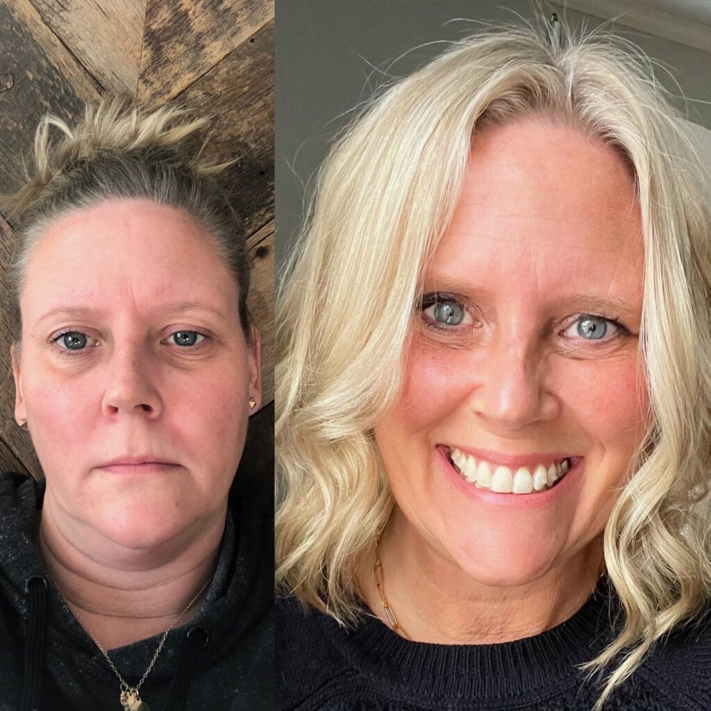 Before and after sobriety photo showing woman with tired expression on left and brighter, healthier appearance on right after quitting drinking