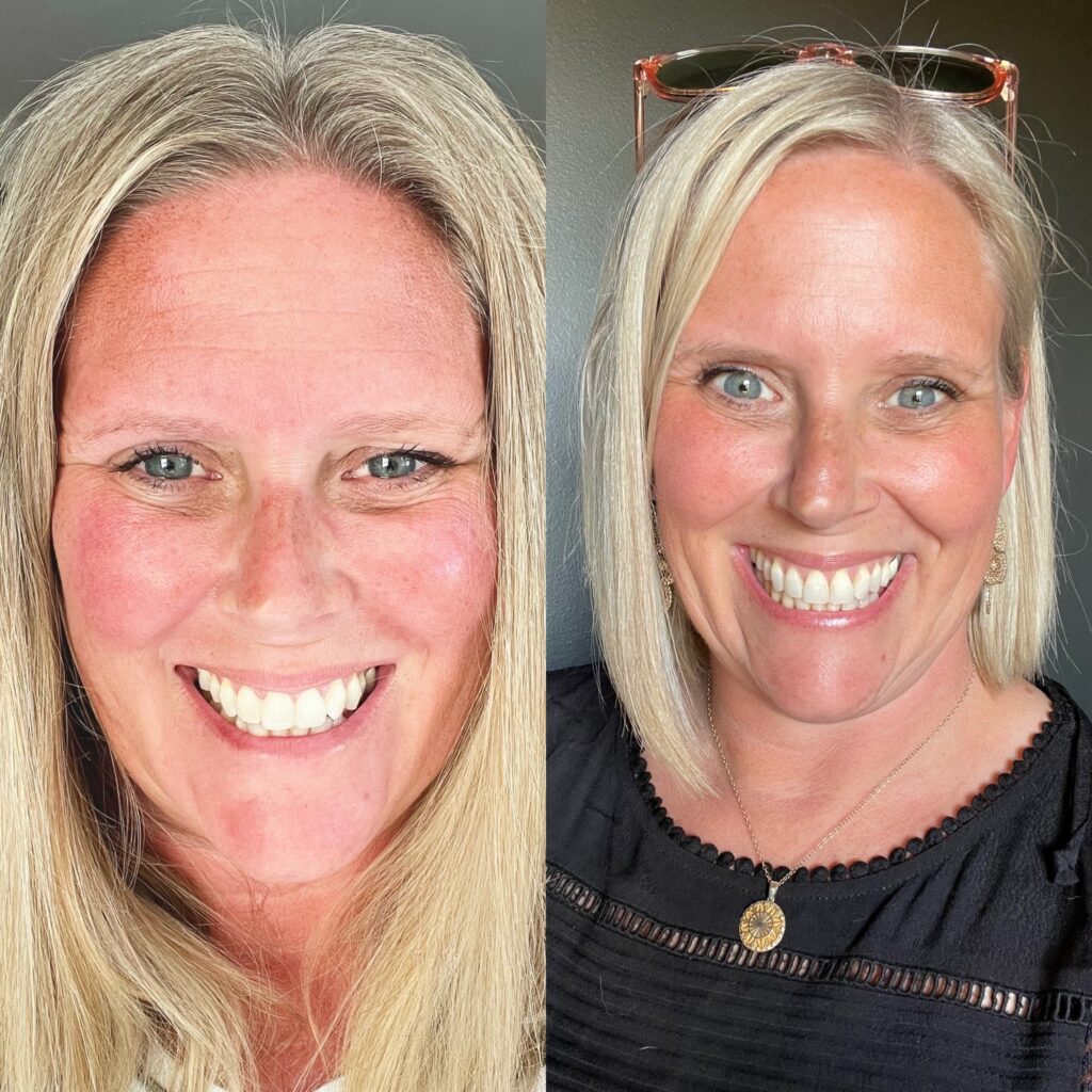 Before and after sobriety photo showing woman with tired expression on left and brighter, healthier appearance on right after quitting drinking